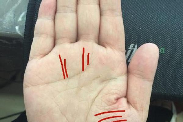 解密手相中的鸡嘴纹路与性格特点