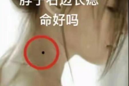 面部痣相与命运：女性脸部痣的象征意义