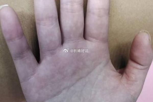 爪子手相解析：如何通过手掌线条识别个性与命运