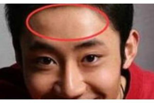 额头凹陷的面相学解析：影响命运的微妙变化