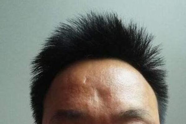 额头凹陷面相的心理与命运暗示