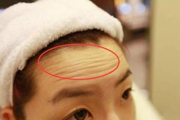 从额头纹看性格特征与人生运势变化