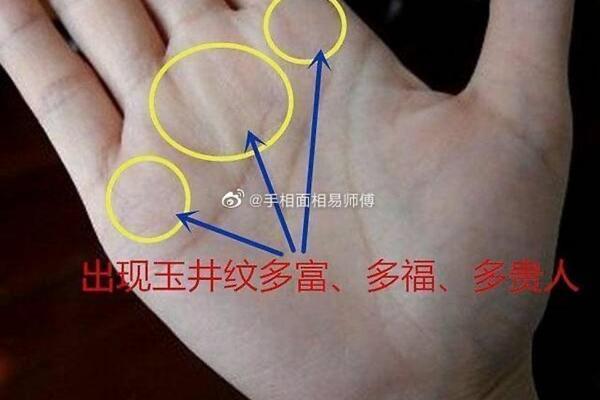 手掌黑痣位置解析：揭示你命运中的隐藏信息