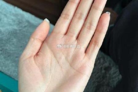 揭秘神奇手相：手指长有肉竟是财运亨通的预兆