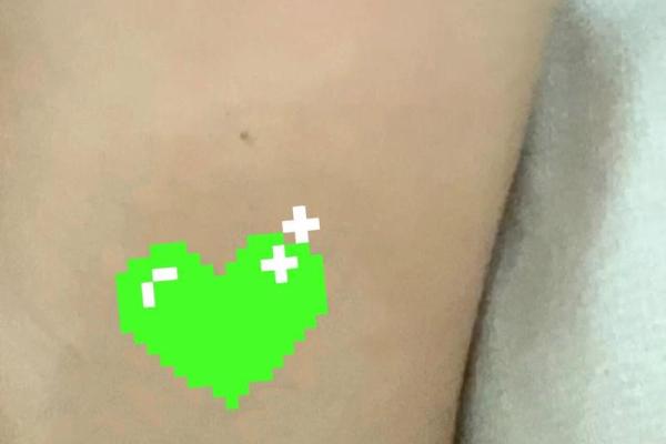 独特魅力：揭秘胳肢窝痣的神秘力量