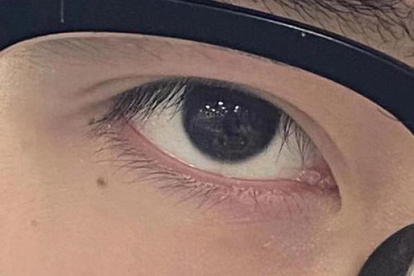 面相识人心，泪痣藏深情——揭秘泪面相的神秘魅力