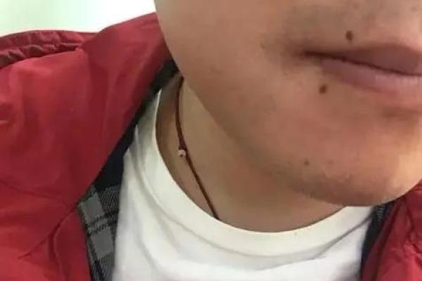 独家解读：口舌痣相的运势解析，让你趋吉避凶
