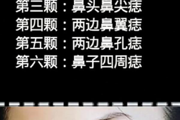 鼻痣揭秘：男人鼻痣相图解，看看你的运势如何？