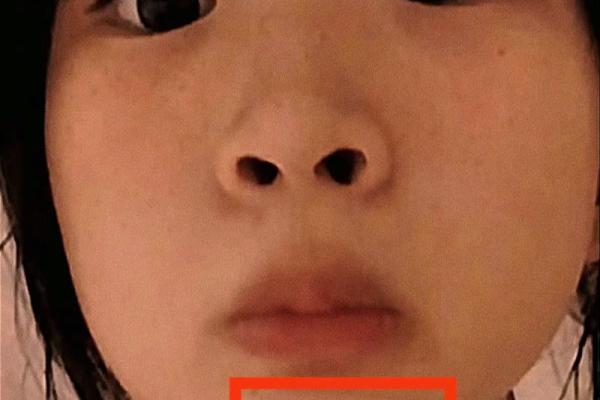 嘴唇附近的痣，是你的幸运痣吗？