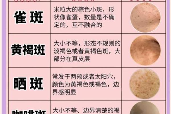 面相揭秘：斑点的秘密，揭秘你的运势与性格
