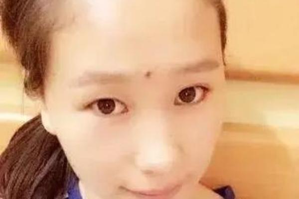 痘坑面相揭秘：看透你的运势与性格