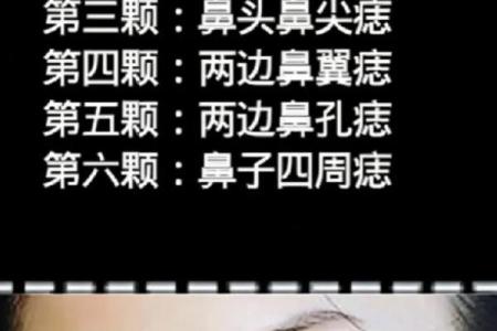鼻痣揭秘：男人鼻痣相图解，看看你的运势如何？