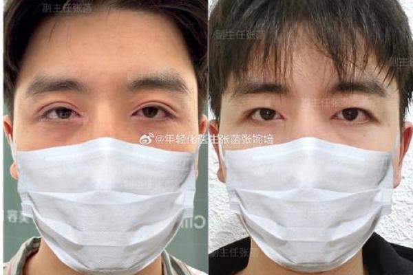 内双面相揭秘：揭秘男生的隐藏魅力