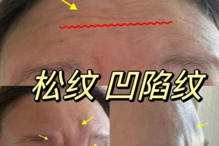 眉心八字纹告诉你，生活中不能忽视的信号