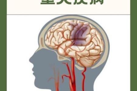 手相暗藏危机：揭秘脑梗的神秘信号