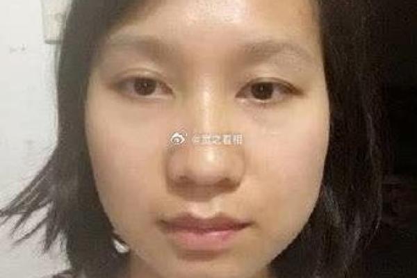 额头变短预示着什么？揭秘面相中的运势与命运转折