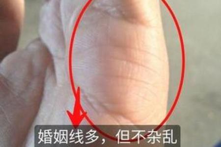 揭秘手相中指甲竖纹的惊人秘密，掌握运势，改变人生