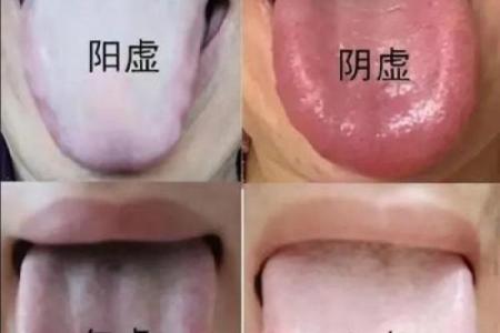 血虚面相揭秘：揭秘你的健康密码，一眼看穿你的气血状况