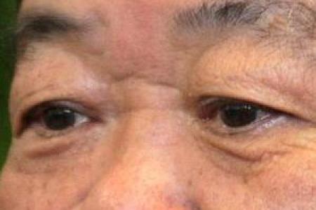面相揭秘：山根横纹暗示运势大逆袭