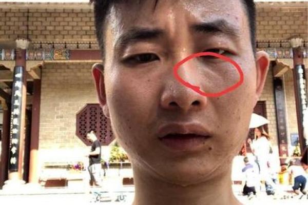 眼部凹陷，揭秘面相中的神秘魅力
