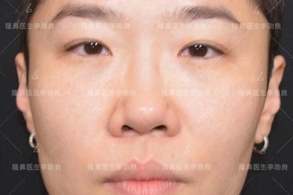 女生鼻尖上翘是个什么命？揭秘命运之谜