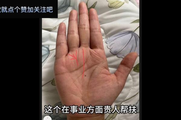掌中藏宝，痣里藏福：揭秘手掌中间有痣的神秘魅力