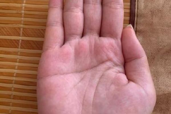 小指根部竖纹揭秘：手相奥秘，揭秘你的命运走势
