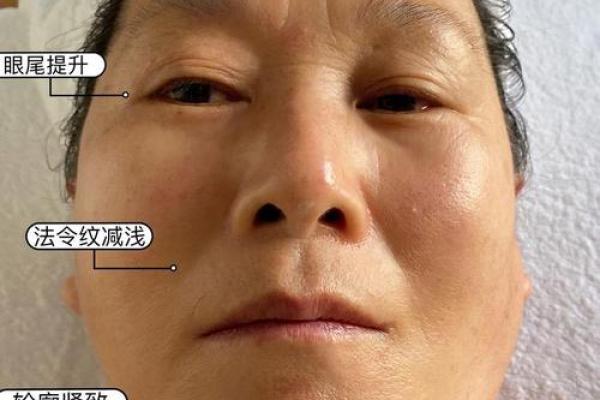 让鼻子八字纹消失，步骤帮你重拾光滑肌肤