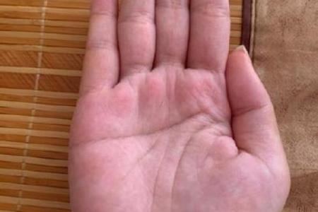 小指根部竖纹揭秘：手相奥秘，揭秘你的命运走势
