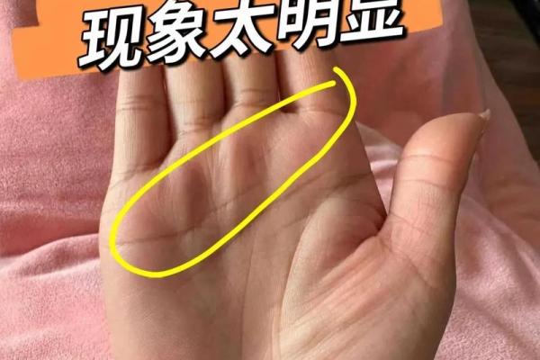 手相揭秘：坎三角纹，财运亨通的秘密