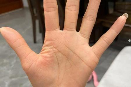手相揭秘：一掌在手，健康状况全知晓