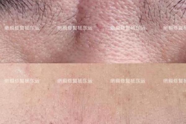 眉痕印记，命运之谜：揭秘疤痕眉的神秘面相学