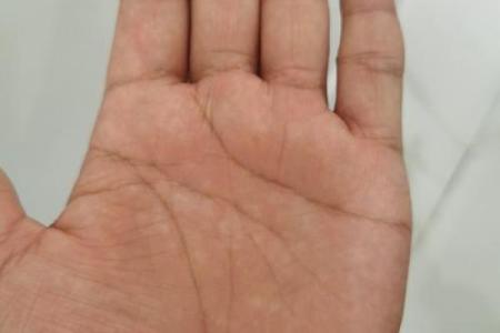 手相揭秘：链形纹预示的财运亨通，你拥有了吗？