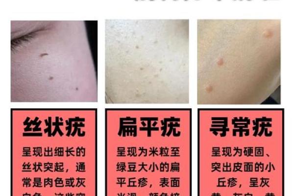 面相疣：揭秘面部疣点的秘密，教你如何辨别运势与健康