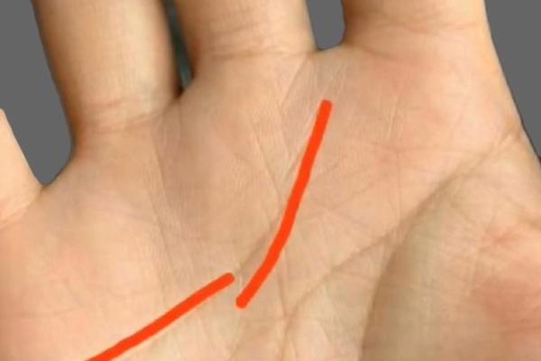 手相揭秘：感情线上的神秘痣，预示着怎样的命运？