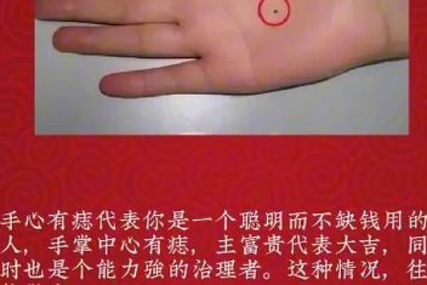 掌心暗藏心语：麻衣神探解读心痣奥秘