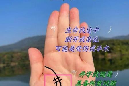 手上痣相揭秘：美丽还是命运？