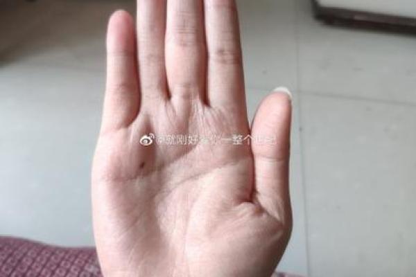 命运之痣，指尖上的秘密