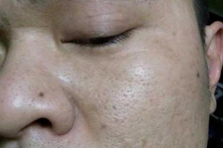 橘皮面相揭秘：面部纹路暗示健康运势，揭秘你的运势密码