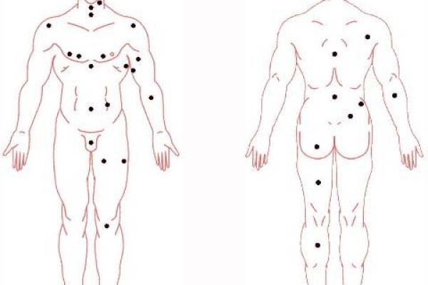 男子双生之谜：痣相背后的神奇力量