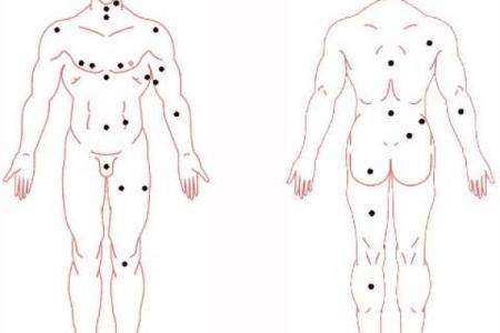 男子双生之谜：痣相背后的神奇力量