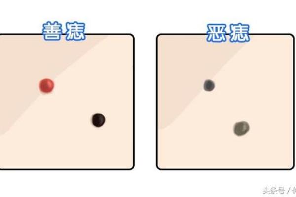 痣相传奇：跟随痣相见证人生起伏