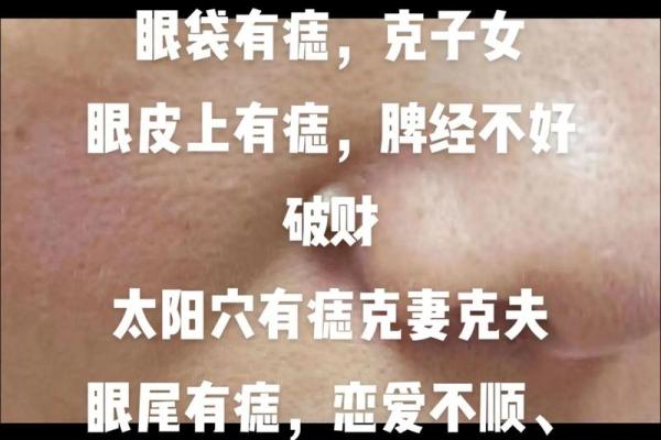 太阳穴上的痣，揭秘你的事业运