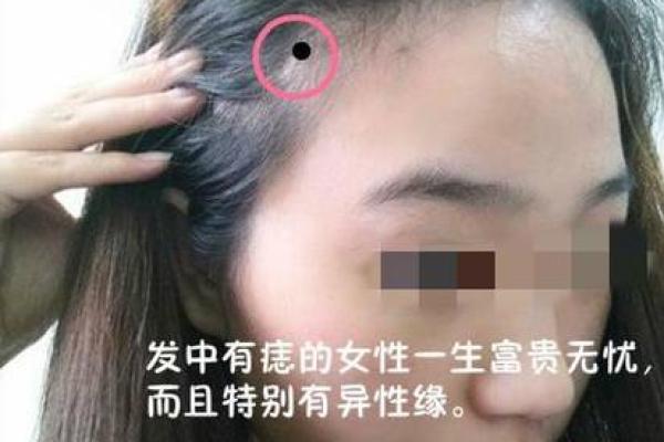 看眼尾长斑，解码人生运势之谜