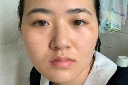 看眼尾长斑，解码人生运势之谜