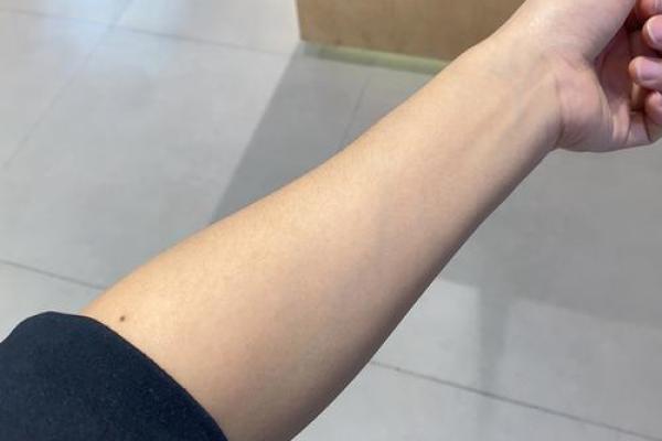 手臂上的痣，是你命中注定的财富象征？