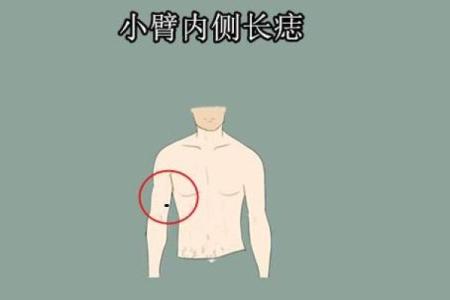 手臂上的痣，是你命中注定的财富象征？